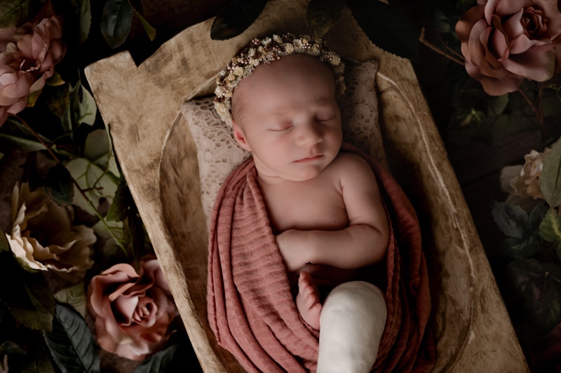 Newborn photoshoot with a girl in a cast for a club foot.